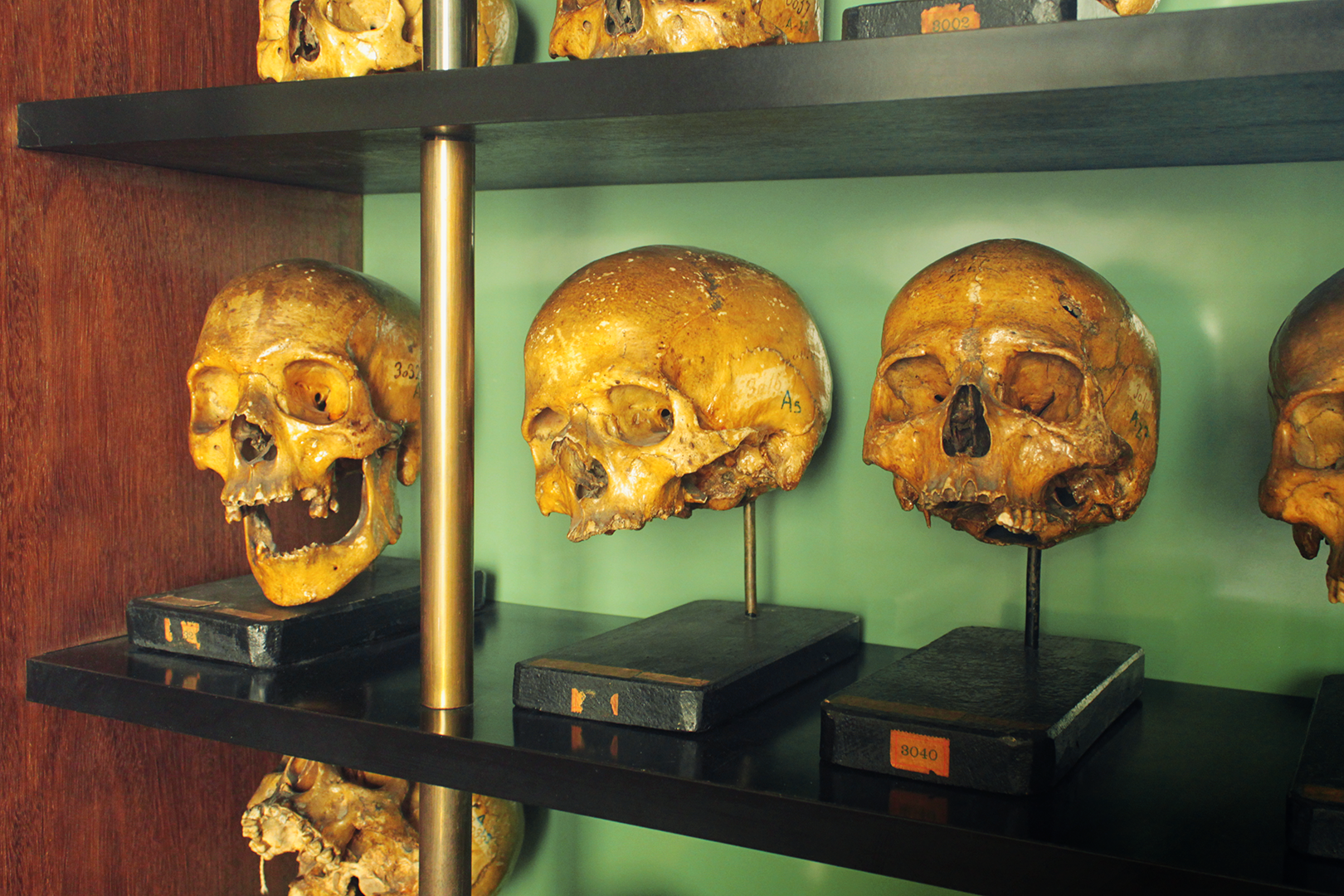 On the trail of Diogo Alves: skull collection in the faculty of medicine of the university of Lisbon.