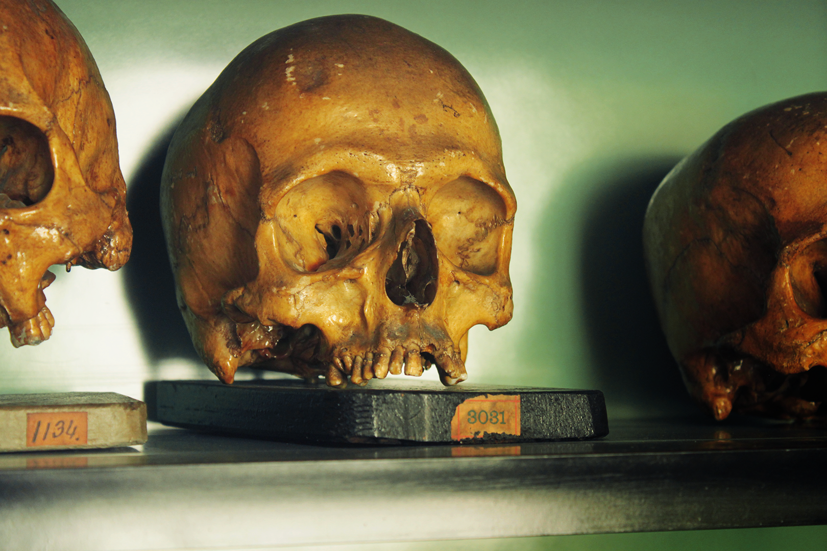 On the trail of Diogo Alves: skull collection in the faculty of medicine of the university of Lisbon.